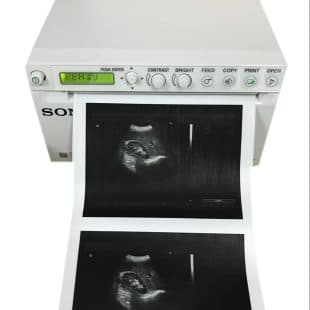 Sony Thermal Printer And Head supplied by Neomeditech in Nepal