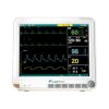 Advanced multi-parameter patient monitor with 12.1 inch LED display for ICU and critical care monitoring in Nepal
